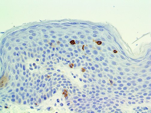 TNFRSF4 / CD134 / OX40 Antibody - IHC of OX-40 on an FFPE Lymph Node Tissue