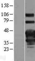 TNFRSF4 / CD134 / OX40 Protein - Western validation with an anti-DDK antibody * L: Control HEK293 lysate R: Over-expression lysate