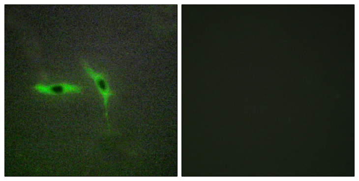 TNFRSF6B / DCR3 Antibody - Immunofluorescence analysis of HepG2 cells, using TNFRSF6B Antibody. The picture on the right is blocked with the synthesized peptide.