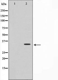 TNFRSF6B / DCR3 Antibody - Western blot analysis on HepG2 cell lysates using TNFRSF6B antibody. The lane on the left is treated with the antigen-specific peptide.