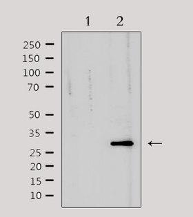 TNFRSF6B / DCR3 Antibody - Western blot analysis of extracts of mouse heart tissue using TNFRSF6B antibody. Lane 1 was treated with the antigen-specific peptide.