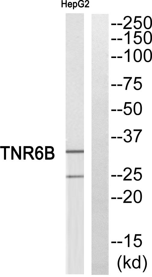 TNFRSF6B / DCR3 Antibody - Western blot analysis of extracts from HepG2 cells, using TNFRSF6B antibody.