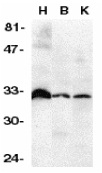 TNFRSF6B / DCR3 Antibody - Western blot of human lysates from heart (H), brain (B) and kidney (K) probed with Rabbit anti-Human DcR3