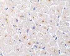 TNFRSF6B / DCR3 Antibody - Immunohistochemistry of human heart with Rabbit anti-Human DcR3