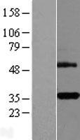 TNFRSF6B / DCR3 Protein - Western validation with an anti-DDK antibody * L: Control HEK293 lysate R: Over-expression lysate