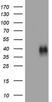TNFRSF9 / 4-1BB / CD137 Antibody - HEK293T cells were transfected with the pCMV6-ENTRY control (Left lane) or pCMV6-ENTRY TNFRSF9 (Right lane) cDNA for 48 hrs and lysed. Equivalent amounts of cell lysates (5 ug per lane) were separated by SDS-PAGE and immunoblotted with anti-TNFRSF9.