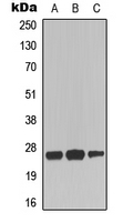 TNFRSF9 / 4-1BB / CD137 Antibody - Western blot analysis of CD137 expression in HepG2 (A); NIH3T3 (B); mouse brain (C) whole cell lysates.
