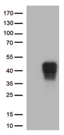 TNFRSF9 / 4-1BB / CD137 Antibody - HEK293T cells were transfected with the pCMV6-ENTRY control. (Left lane) or pCMV6-ENTRY TNFRSF9. (Right lane) cDNA for 48 hrs and lysed. Equivalent amounts of cell lysates. (5 ug per lane) were separated by SDS-PAGE and immunoblotted with anti-TNFRSF9. (1:500)