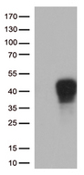 TNFRSF9 / 4-1BB / CD137 Antibody - HEK293T cells were transfected with the pCMV6-ENTRY control. (Left lane) or pCMV6-ENTRY TNFRSF9. (Right lane) cDNA for 48 hrs and lysed. Equivalent amounts of cell lysates. (5 ug per lane) were separated by SDS-PAGE and immunoblotted with anti-TNFRSF9. (1:500)