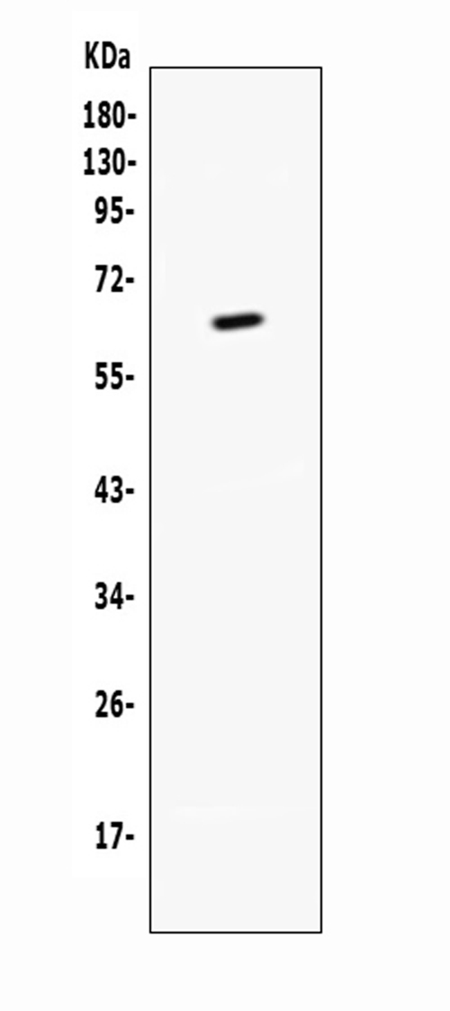 TNFRSF9 / 4-1BB / CD137 Antibody - Western blot analysis of CD137 using anti-CD137 antibody. Electrophoresis was performed on a 5-20% SDS-PAGE gel at 70V (Stacking gel) / 90V (Resolving gel) for 2-3 hours. Lane 1: recombinant mouse CD137 protein 1ng. After Electrophoresis, proteins were transferred to a Nitrocellulose membrane at 150mA for 50-90 minutes. Blocked the membrane with 5% Non-fat Milk/ TBS for 1.5 hour at RT. The membrane was incubated with rabbit anti-CD137 antigen affinity purified polyclonal antibody at 0.5 µg/mL overnight at 4°C, then washed with TBS-0.1% Tween 3 times with 5 minutes each and probed with a goat anti-rabbit IgG-HRP secondary antibody at a dilution of 1:10000 for 1.5 hour at RT. The signal is developed using an Enhanced Chemiluminescent detection (ECL) kit with Tanon 5200 system. A specific band was detected for CD137 at approximately 65KD. The expected band size for CD137 is at 44KD.