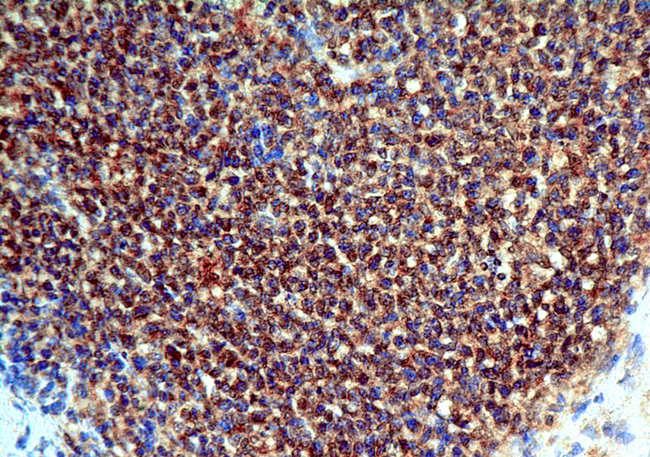 TNFRSF9 / 4-1BB / CD137 Antibody - Fig-3: Immunohistochemical analysis of CD137. Anti-CD137 was used in Human Tonsil tissue at 2 µg/ml.