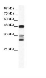 TNFSF10 / TRAIL Antibody - Hela Cell Lysate.  This image was taken for the unconjugated form of this product. Other forms have not been tested.