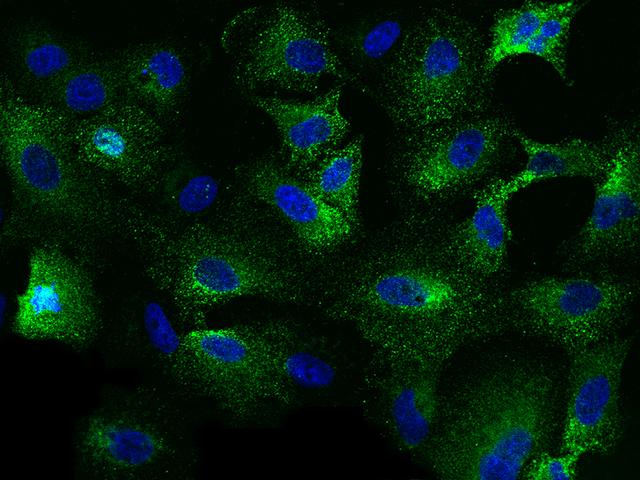 TNFSF10 / TRAIL Antibody - Immunofluorescence staining of TNFSF10 in A549 cells. Cells were fixed with 4% PFA, blocked with 10% serum, and incubated with mouse anti-human TNFSF10 monoclonal antibody (dilution ratio 1:60) at 4°C overnight. Then cells were stained with the Alexa Fluor 488-conjugated Goat Anti-mouse IgG secondary antibody (green) and counterstained with DAPI (blue). Positive staining was localized to Cytoplasm.