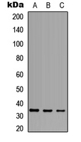 TNFSF10 / TRAIL Antibody - Western blot analysis of CD253 expression in HEK293T (A); Raw264.7 (B); H9C2 (C) whole cell lysates.