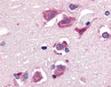 TNFSF10 / TRAIL Antibody - Immunohistochemistry of TRAIL in human brain tissue with TRAIL antibody at 20 ug/ml.