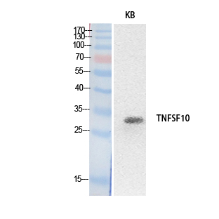 TNFSF10 / TRAIL Antibody - Western Blot analysis of extracts from HeLa cells using TNFSF10 Antibody.