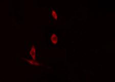 TNFSF10 / TRAIL Antibody - Staining HuvEc cells by IF/ICC. The samples were fixed with PFA and permeabilized in 0.1% Triton X-100, then blocked in 10% serum for 45 min at 25°C. The primary antibody was diluted at 1:200 and incubated with the sample for 1 hour at 37°C. An Alexa Fluor 594 conjugated goat anti-rabbit IgG (H+L) Ab, diluted at 1/600, was used as the secondary antibody.