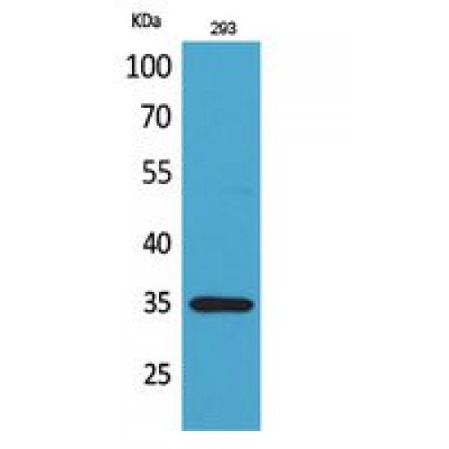 TNFSF11 / RANKL / TRANCE Antibody - Western blot of RANKL antibody