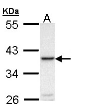 TNFSF11 / RANKL / TRANCE Antibody - Sample (30 ug of whole cell lysate). A: Molt-4 . 10% SDS PAGE. RANKL antibody diluted at 1:1000.
