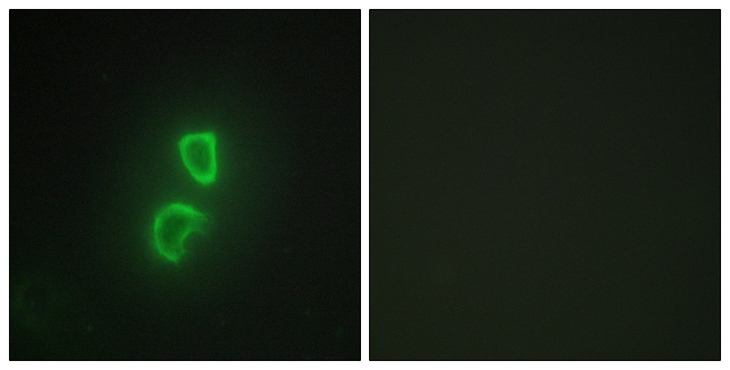 TNFSF11 / RANKL / TRANCE Antibody - Immunofluorescence analysis of HepG2 cells, using TNFSF11 Antibody. The picture on the right is blocked with the synthesized peptide.