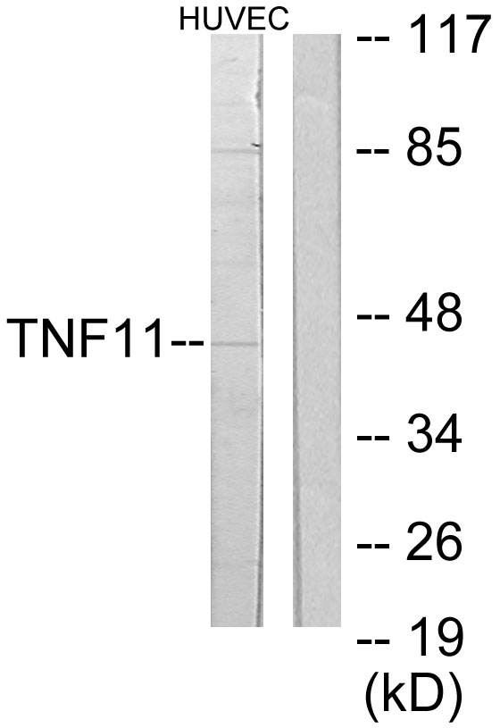 TNFSF11 / RANKL / TRANCE Antibody - Western blot analysis of lysates from HUVEC cells, using TNFSF11 Antibody. The lane on the right is blocked with the synthesized peptide.