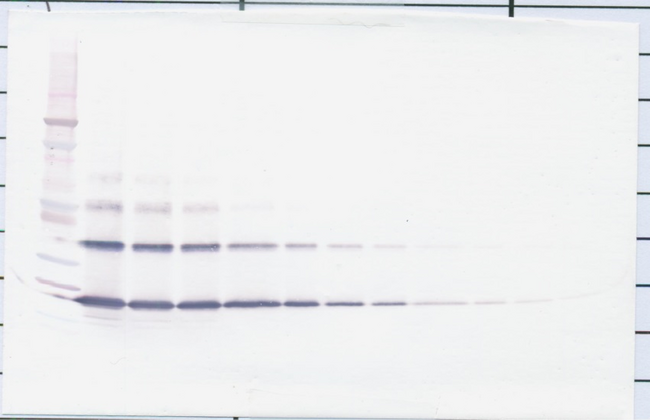 TNFSF11 / RANKL / TRANCE Antibody - Biotinylated Anti-Human sRANK Ligand (Polyclonal Rabbit) Western Blot Reduced