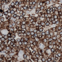 TNFSF11 / RANKL / TRANCE Antibody - Immunohistochemical analysis of CD254 staining in human lymph node formalin fixed paraffin embedded tissue section. The section was pre-treated using heat mediated antigen retrieval with sodium citrate buffer (pH 6.0). The section was then incubated with the antibody at room temperature and detected using an HRP-conjugated compact polymer system. DAB was used as the chromogen. The section was then counterstained with hematoxylin and mounted with DPX.