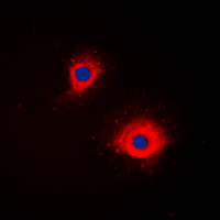 TNFSF11 / RANKL / TRANCE Antibody - Immunofluorescent analysis of CD254 staining in Jurkat cells. Formalin-fixed cells were permeabilized with 0.1% Triton X-100 in TBS for 5-10 minutes and blocked with 3% BSA-PBS for 30 minutes at room temperature. Cells were probed with the primary antibody in 3% BSA-PBS and incubated overnight at 4 deg C in a humidified chamber. Cells were washed with PBST and incubated with a DyLight 594-conjugated secondary antibody (red) in PBS at room temperature in the dark. DAPI was used to stain the cell nuclei (blue).