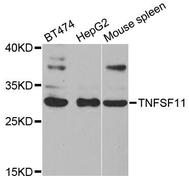 TNFSF11 / RANKL / TRANCE Antibody - Western blot analysis of extracts of various cell lines.