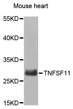TNFSF11 / RANKL / TRANCE Antibody - Western blot analysis of extracts of Mouse heart cells.