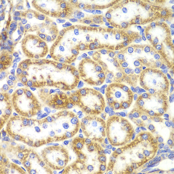 TNFSF11 / RANKL / TRANCE Antibody - Immunohistochemistry of paraffin-embedded rat kidney tissue.