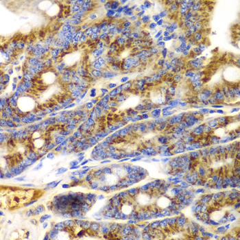 TNFSF11 / RANKL / TRANCE Antibody - Immunohistochemistry of paraffin-embedded mouse Intestine.