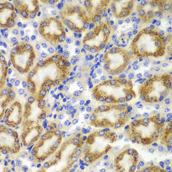 TNFSF11 / RANKL / TRANCE Antibody - Immunohistochemistry of paraffin-embedded mouse kidney tissue.