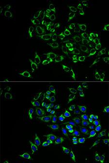TNFSF11 / RANKL / TRANCE Antibody - Immunofluorescence analysis of HeLa cells.