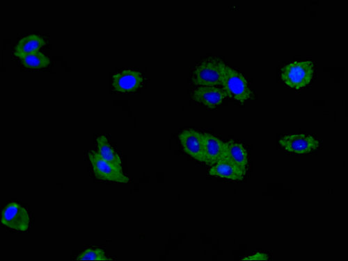 TNFSF11 / RANKL / TRANCE Antibody - Immunofluorescent analysis of HepG2 cells using TNFSF11 Antibody at a dilution of 1:100 and Alexa Fluor 488-congugated AffiniPure Goat Anti-Rabbit IgG(H+L)