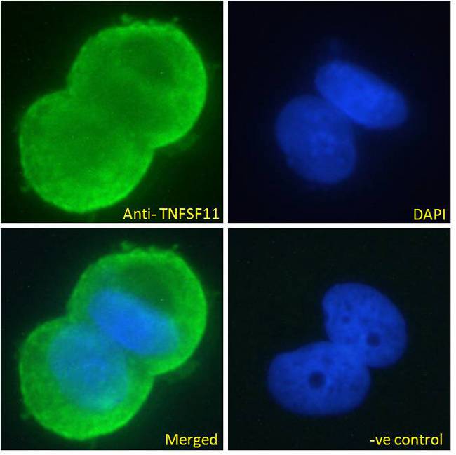 TNFSF11 / RANKL / TRANCE Antibody - Immunofluorescence analysis of paraformaldehyde fixed MCF7 cells, permeabilized with 0.15% Triton. Primary incubation 1hr (10ug/ml) followed by Alexa Fluor 488 secondary antibody (2ug/ml), showing membrane and secreted staining. The nuclear stain is DAPI (blue). Negative control: Unimmunized goat IgG (10ug/ml) followed by Alexa Fluor 488 secondary antibody (2ug/ml).