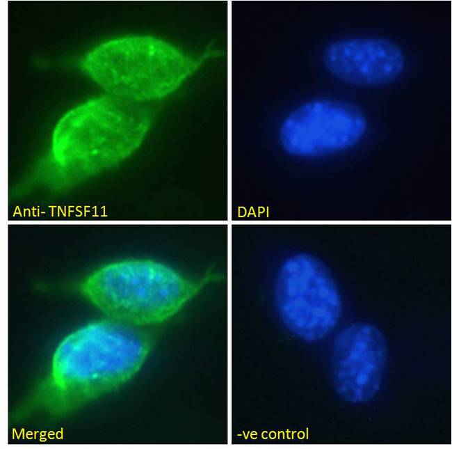 TNFSF11 / RANKL / TRANCE Antibody - Immunofluorescence analysis of paraformaldehyde fixed NIH3T3 cells, permeabilized with 0.15% Triton. Primary incubation 1hr (10ug/ml) followed by Alexa Fluor 488 secondary antibody (2ug/ml), showing membrane and secreted staining. The nuclear stain is DAPI (blue). Negative control: Unimmunized goat IgG (10ug/ml) followed by Alexa Fluor 488 secondary antibody (2ug/ml).