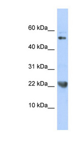 TNFSF12 / TWEAK Antibody - TNFSF12 / TWEAK antibody Western blot of 721_B cell lysate. This image was taken for the unconjugated form of this product. Other forms have not been tested.