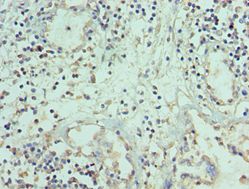 TNFSF12 / TWEAK Antibody - Immunohistochemistry of paraffin-embedded human prostate using antibody at 1:100 dilution.