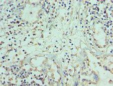 TNFSF12 / TWEAK Antibody - Immunohistochemistry of paraffin-embedded human prostate using antibody at 1:100 dilution.