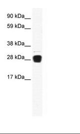 TNFSF12 / TWEAK Antibody - Fetal Skeletal Muscle Lysate.  This image was taken for the unconjugated form of this product. Other forms have not been tested.