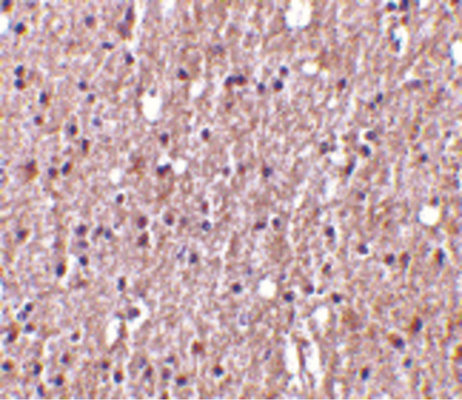 TNFSF12 / TWEAK Antibody - Immunohistochemistry of TWEAK in human brain tissue with TWEAK antibody at 10 ug/ml.