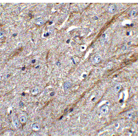 TNFSF12 / TWEAK Antibody - Immunohistochemistry of TWEAK in mouse brain tissue with TWEAK antibody at 5 µg/mL.