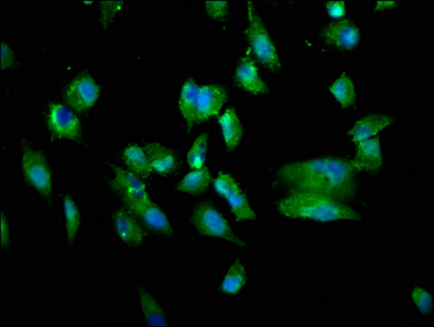 TNFSF12 / TWEAK Antibody - Immunofluorescence staining of Hela cells with TNFSF12 Antibody at 1:333, counter-stained with DAPI. The cells were fixed in 4% formaldehyde, permeabilized using 0.2% Triton X-100 and blocked in 10% normal Goat Serum. The cells were then incubated with the antibody overnight at 4°C. The secondary antibody was Alexa Fluor 488-congugated AffiniPure Goat Anti-Rabbit IgG(H+L).