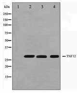 TNFSF12 / TWEAK Antibody - Western blot of HUVEC,Jurkat and 293 cell lysate using TNFSF12 Antibody