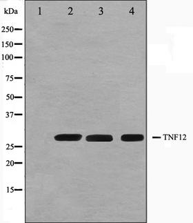 TNFSF12 / TWEAK Antibody - Western blot analysis on HuvEc, Jurkat and 293 cell lysates using TNFSF12 antibody. The lane on the left is treated with the antigen-specific peptide.