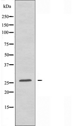 TNFSF12 / TWEAK Antibody - Western blot analysis of extracts of COLO cells using TNF12 antibody.