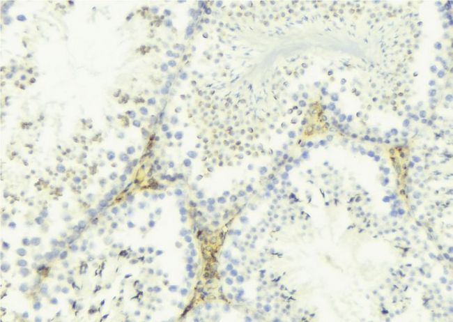 TNFSF12 / TWEAK Antibody - 1:100 staining mouse testis tissue by IHC-P. The sample was formaldehyde fixed and a heat mediated antigen retrieval step in citrate buffer was performed. The sample was then blocked and incubated with the antibody for 1.5 hours at 22°C. An HRP conjugated goat anti-rabbit antibody was used as the secondary.