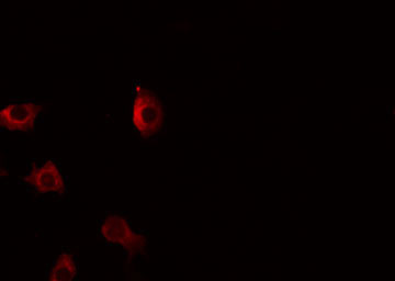 TNFSF12 / TWEAK Antibody - Staining COLO205 cells by IF/ICC. The samples were fixed with PFA and permeabilized in 0.1% Triton X-100, then blocked in 10% serum for 45 min at 25°C. The primary antibody was diluted at 1:200 and incubated with the sample for 1 hour at 37°C. An Alexa Fluor 594 conjugated goat anti-rabbit IgG (H+L) Ab, diluted at 1/600, was used as the secondary antibody.