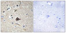 TNFSF12 / TWEAK Antibody - Peptide - + Immunohistochemistry analysis of paraffin-embedded human brain tissue using TNF12 antibody.